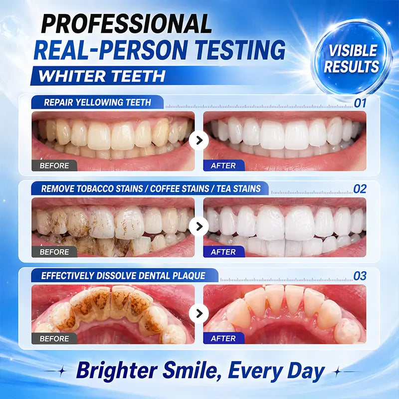 【Family Value Pack】AVTVA®Niacinamide Whitening Toothpaste for a Brighter, Fresher Smile
