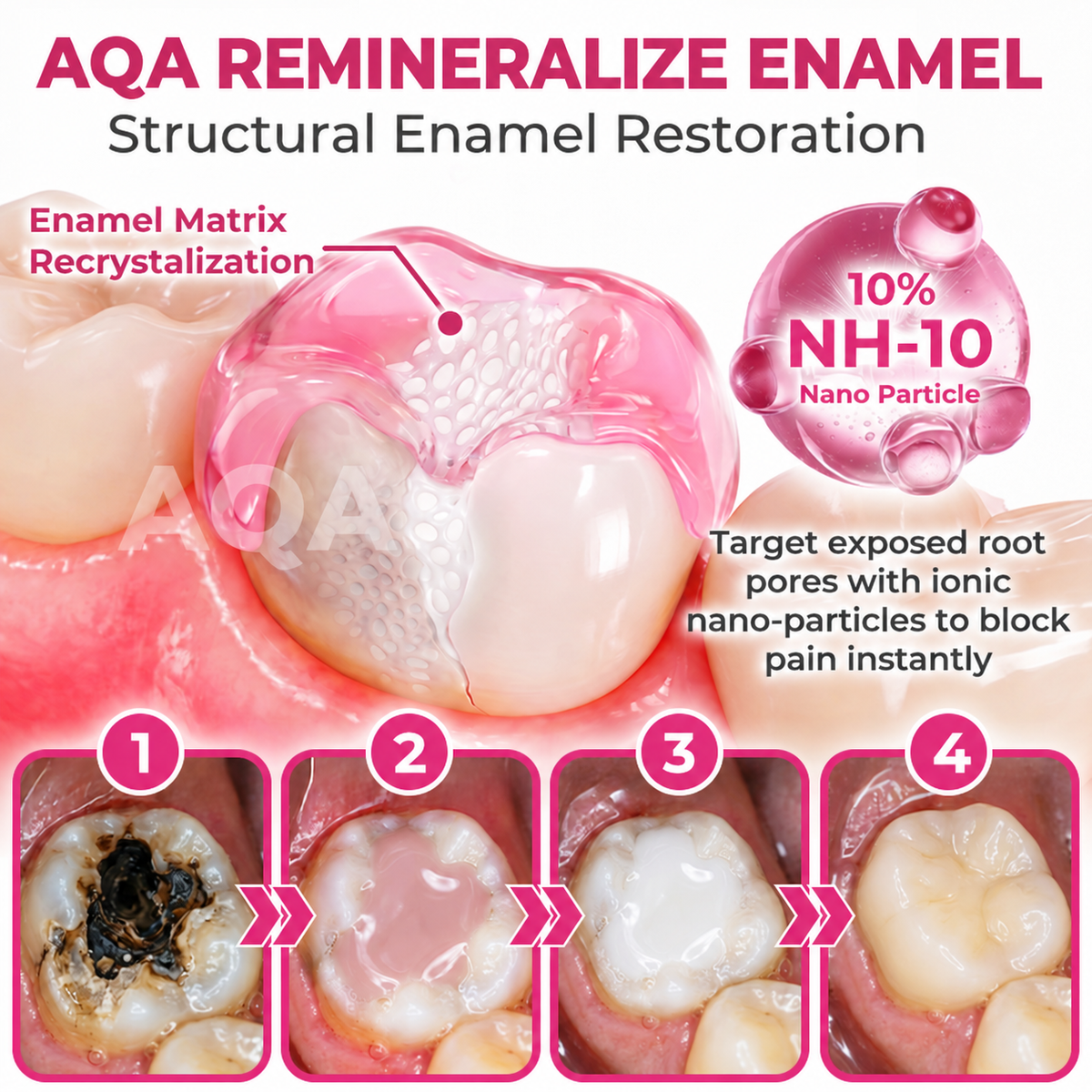 AQA®  Cavity-Repair Natural Enamel Filling Gel